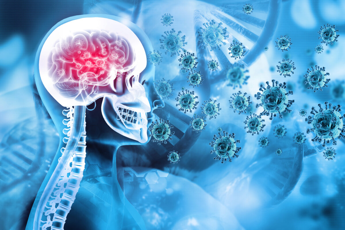 An increasing number of neurological complications after the COVID-19 vaccine