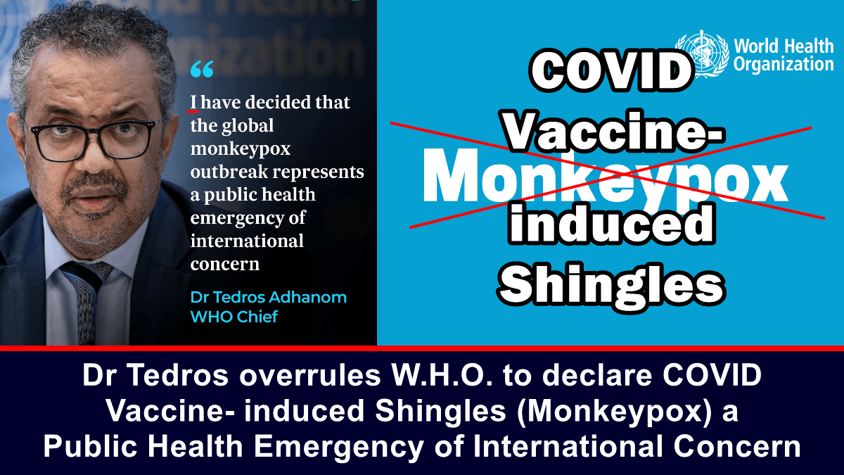 Tedros, DS'nn COVID aısının neden olduğu zona (maymun ieği) uluslararası halk sağlığı acil durumu ilan etmesini geersiz kıldı